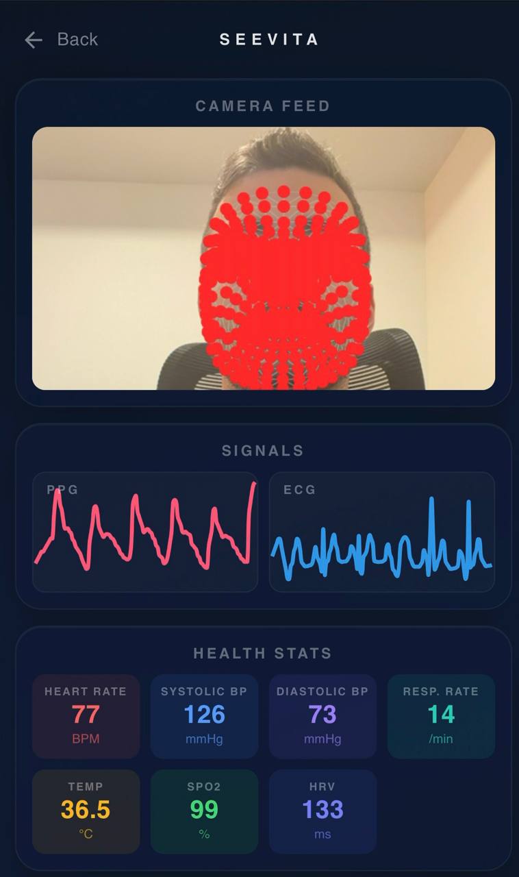 SeeVita mobile app monitoring details screenshot