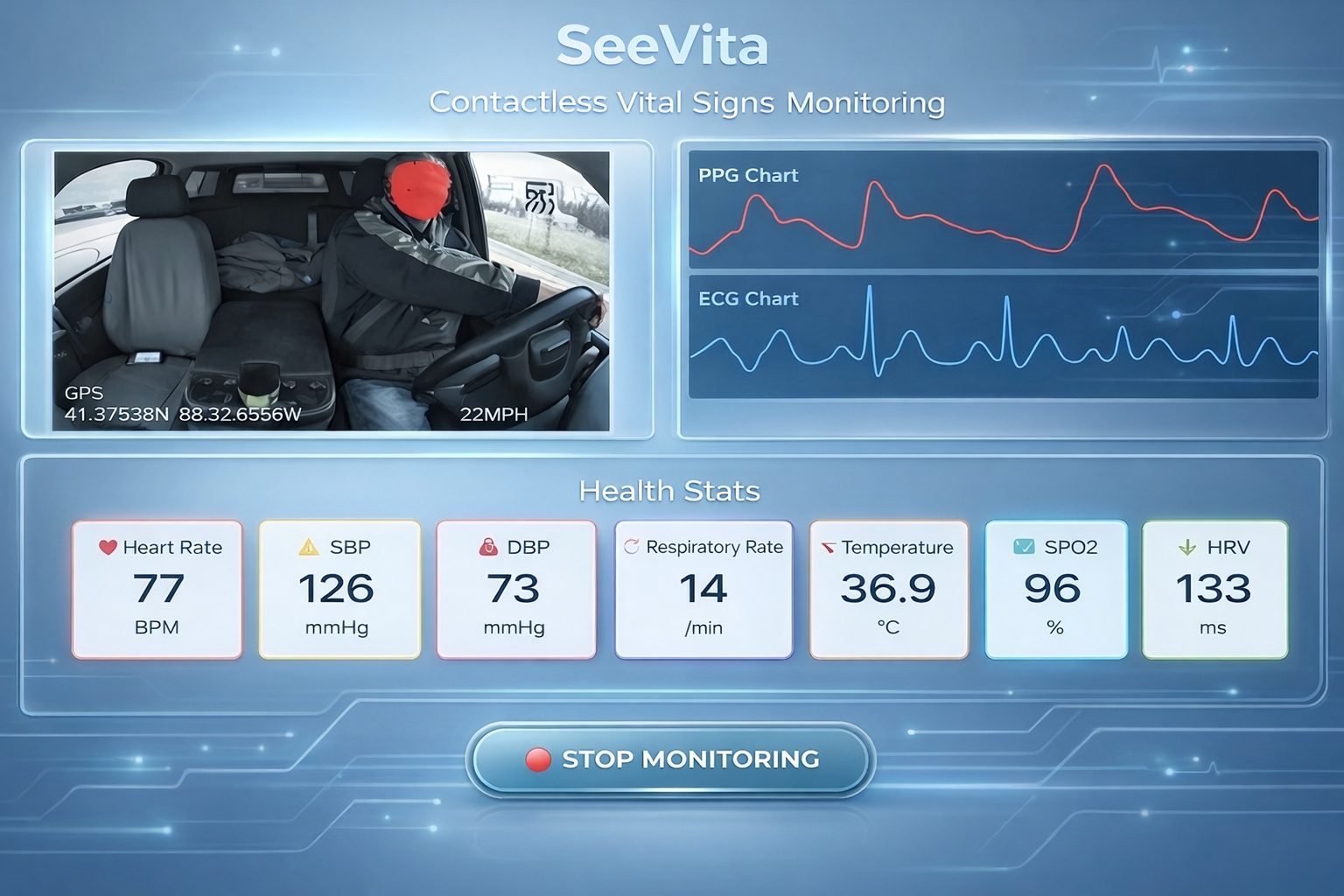 SeeVita monitoring visual with four vital sign windows